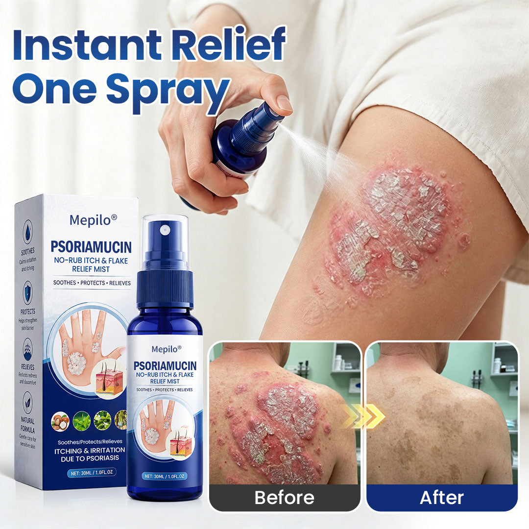 Mepilo® PsoriaMucin No-Rub Itch & Flake Relief Mist