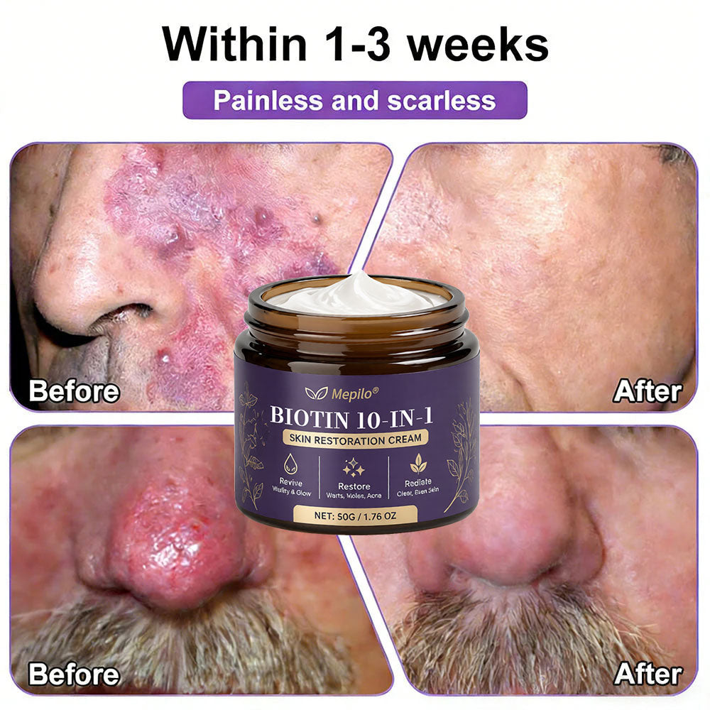 ✨Mepilo® Biotin 10-in-1 Skin Restoration Cream 🍀