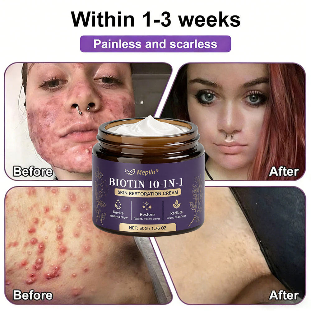 ✨Mepilo® Biotin 10-in-1 Skin Restoration Cream 🍀