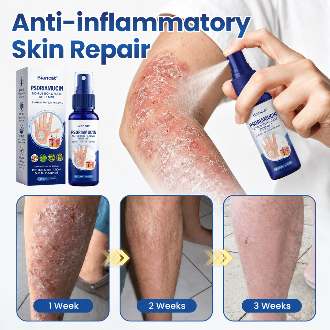 Mepilo® PsoriaMucin No-Rub Itch & Flake Relief Mist