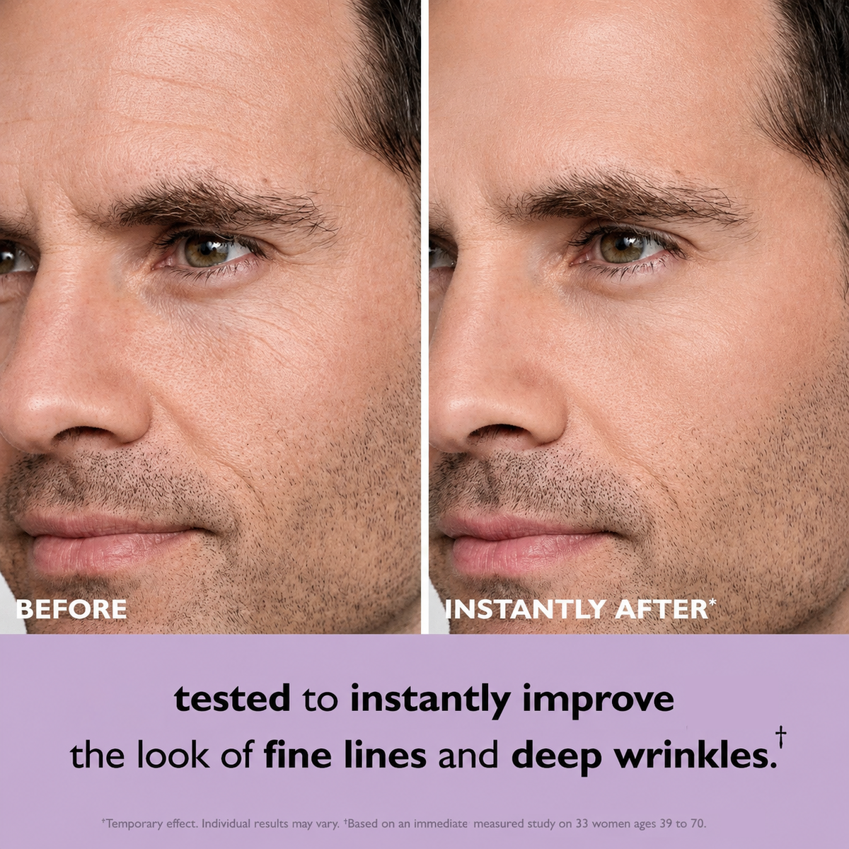 Reverse-Aging Eye Tightener
