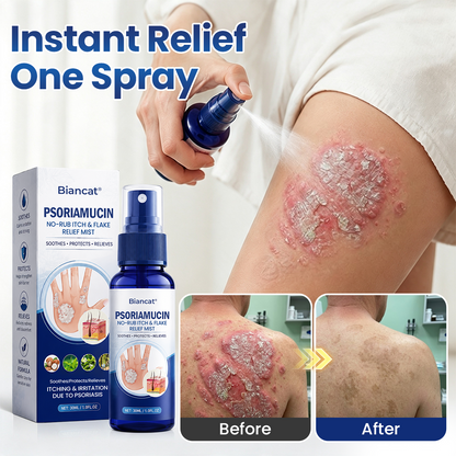 Mepilo® PsoriaMucin No-Rub Itch & Flake Relief Mist